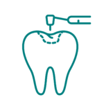 Dental restoration in Portsmouth, Fillings