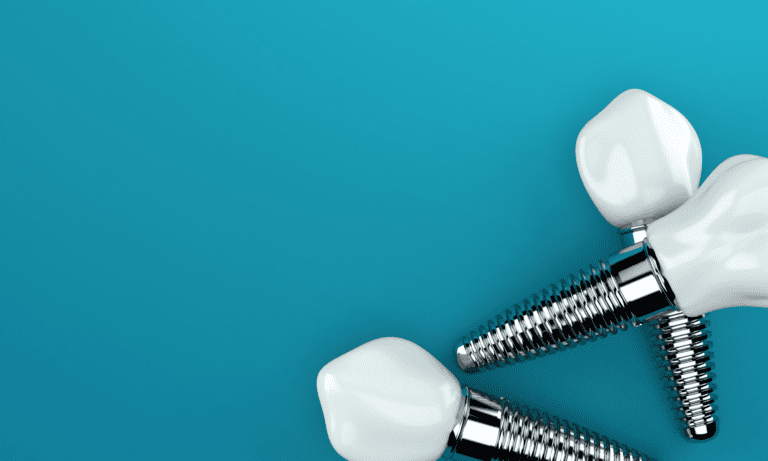 dental implants