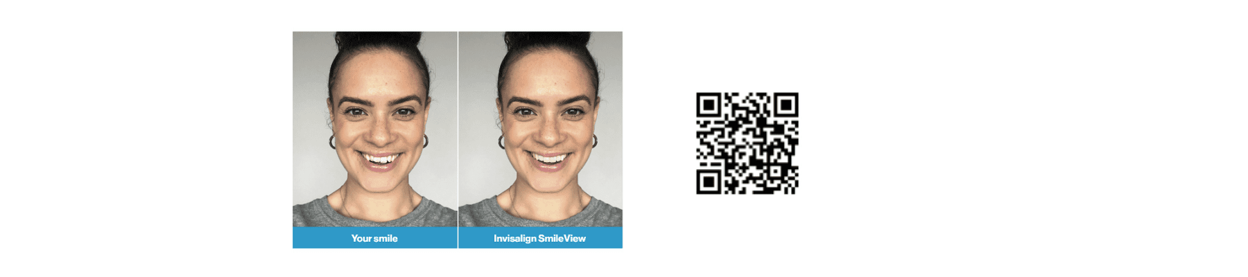 Invisalign Smile View